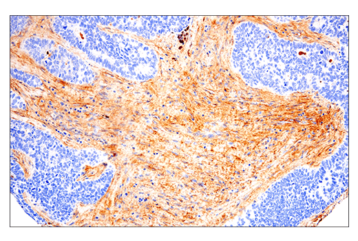 undefined Image 51: Extracellular Matrix Dynamics Antibody Sampler Kit