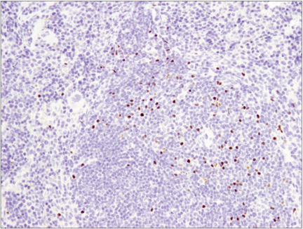 Immunohistochemical analysis of paraffin-embedded spleen using FoxP3 (D6O8R) Rabbit mAb