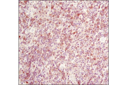 Immunohistochemistry Image 3: RSK2 (D21B2) XP<sup>®</sup> Rabbit mAb (BSA and Azide Free)
