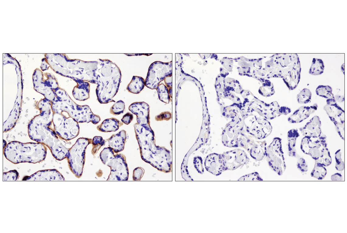 Immunohistochemistry Image 2: PD-L1 (E1L3N<sup>®</sup>) XP<sup>®</sup> Rabbit mAb (BSA and Azide Free)