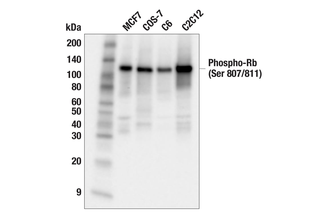 Western Blotting Image 3: Phospho-Rb (Ser807/811) (D20B12) XP<sup>®</sup> Rabbit mAb