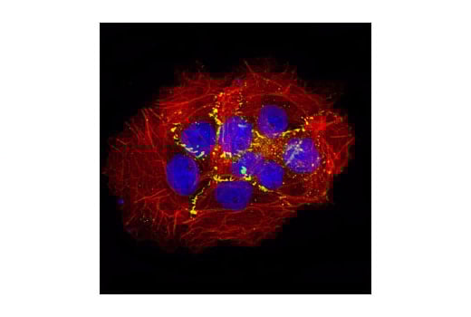 undefined Image 10: Tight Junction Antibody Sampler Kit