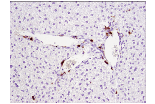 undefined Image 30: Mouse Reactive M1 vs M2 Macrophage IHC Antibody Sampler Kit