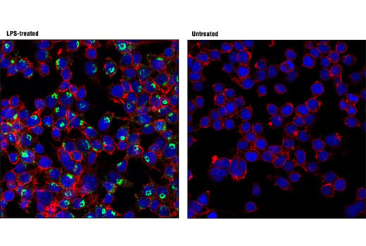 Immunofluorescence Image 1: TNF-α (D2D4) XP<sup>®</sup> Rabbit mAb