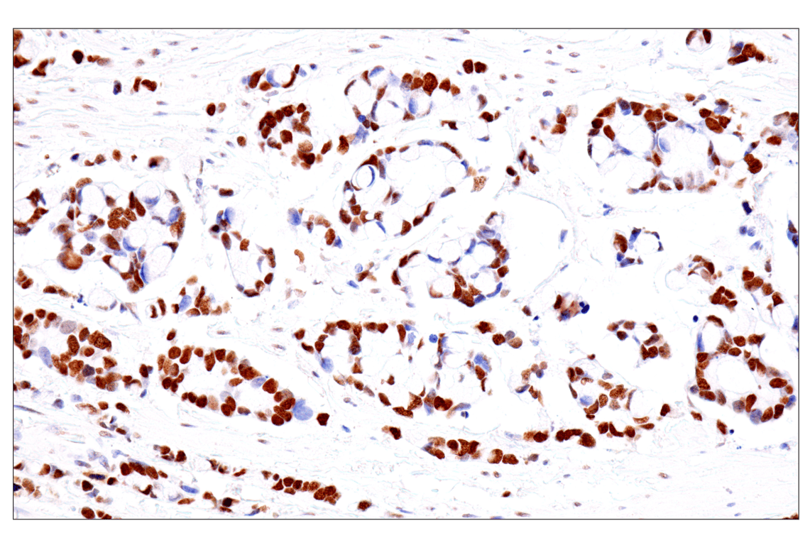 Immunohistochemistry Image 10: FoxA1/HNF3α (IHC578) Mouse mAb