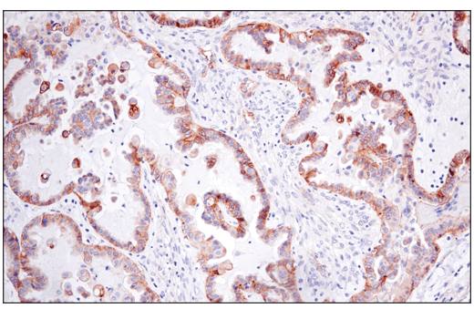 Immunohistochemistry Image 1: CD151 (E4I9J) XP<sup>®</sup> Rabbit mAb