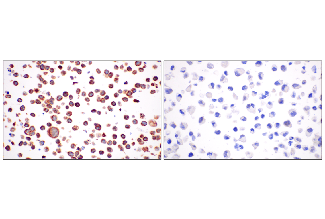 Immunohistochemistry Image 9: CPT1A (E3Y1V) Rabbit mAb
