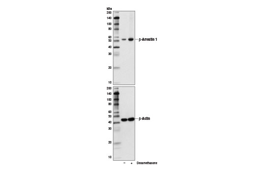 Western Blotting Image 2: β-Arrestin 1 (D7Z3W) XP<sup>®</sup> Rabbit mAb
