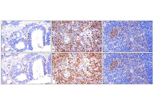undefined Image 91: Human Exhausted CD8<sup>+</sup> T Cell IHC Antibody Sampler Kit