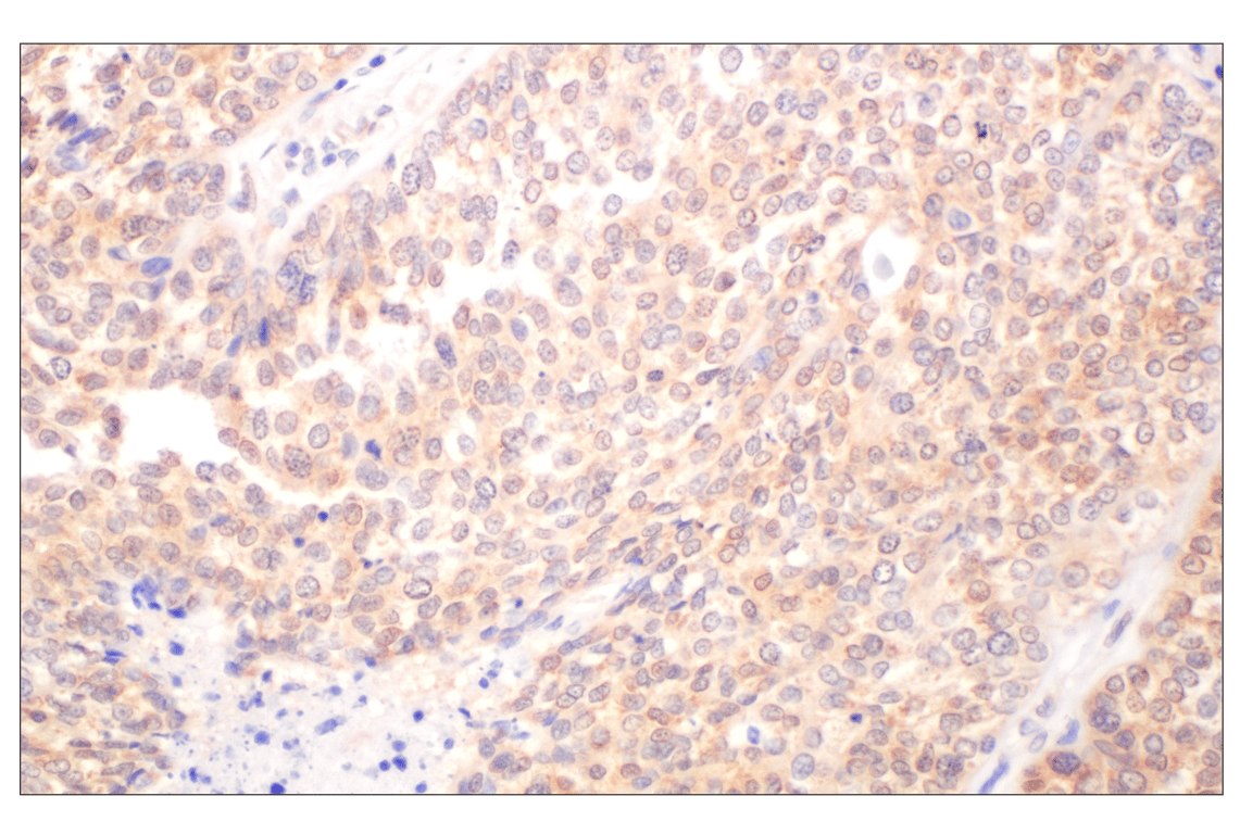 Immunohistochemistry Image 7: Galectin-8/LGALS8 (F9O3T) Rabbit mAb