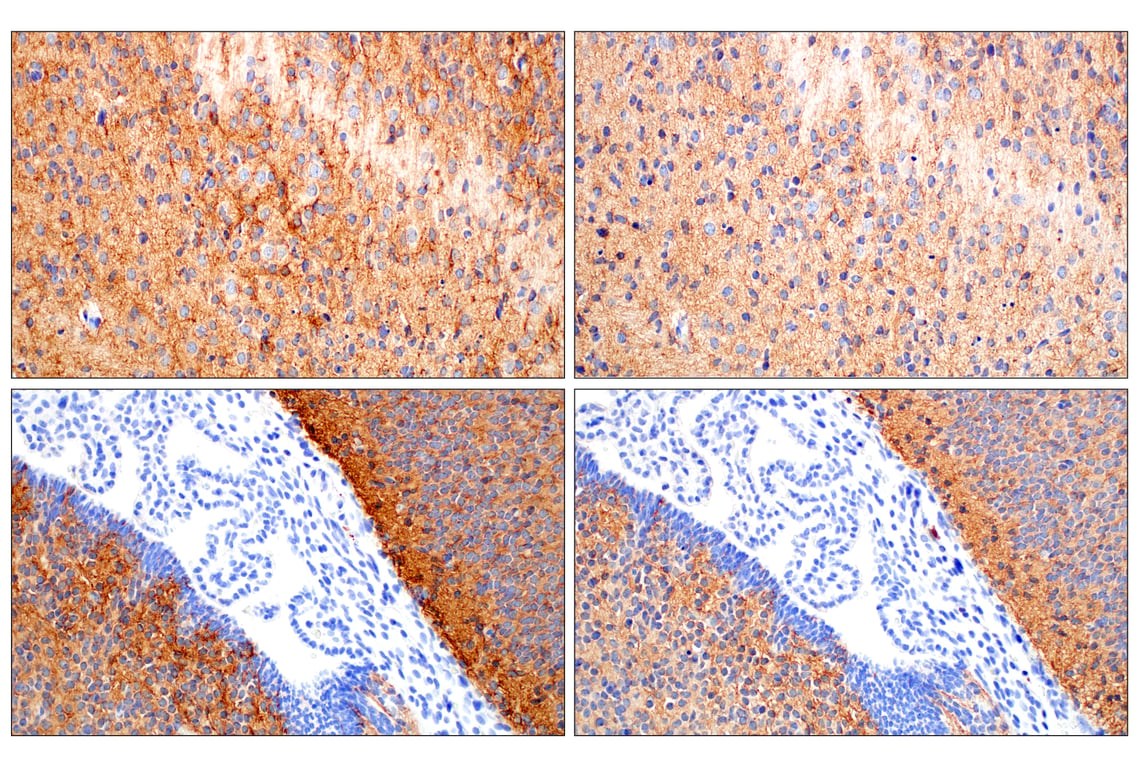 Immunohistochemistry Image 5: Doublecortin (E3S7L) Rabbit mAb (BSA and Azide Free)