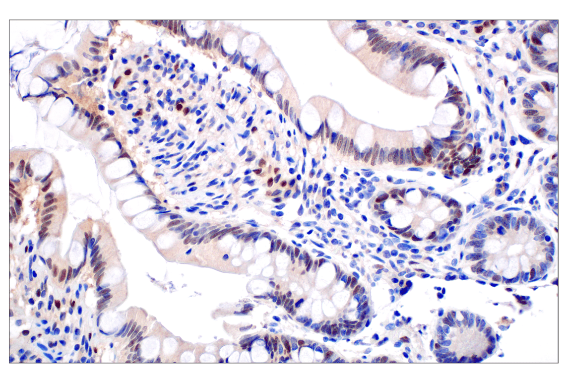 Immunohistochemistry Image 7: ID1 (F2M1J) Rabbit mAb (BSA and Azide Free)