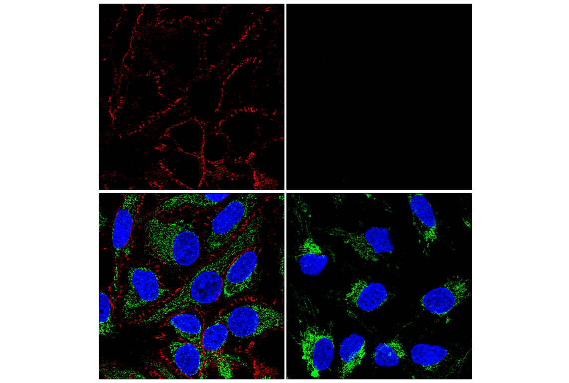 Immunofluorescence Image 1: β-Catenin (D10A8) XP<sup>®</sup> Rabbit mAb (Alexa Fluor<sup>®</sup> 647 Conjugate)