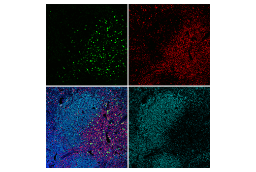 Immunofluorescence Image 2: IL-2Rα/CD25 (E9W2J) XP<sup>®</sup> Rabbit mAb