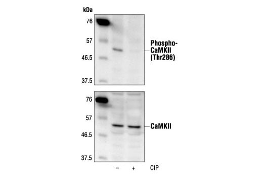 Western Blotting Image 2: Phospho-CaMKII (Thr286) Antibody