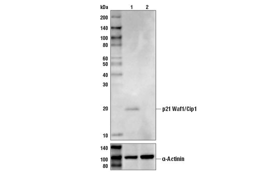 Western Blotting Image 1: p21 Waf1/Cip1 (DCS60) Mouse mAb