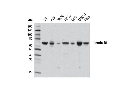 Western Blotting Image 2: Lamin B1 (D4Q4Z) Rabbit mAb
