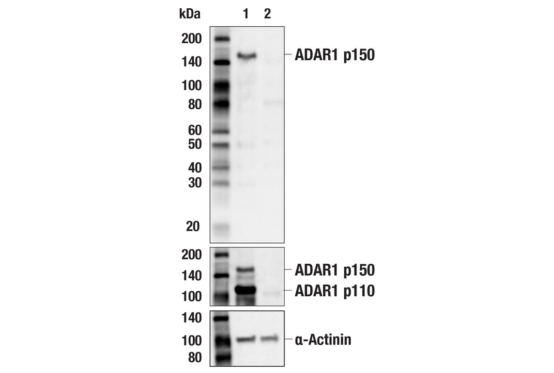 Western Blotting Image 1: ADAR1 p150 Isoform   (E6U1U) Rabbit mAb   (BSA and Azide Free)