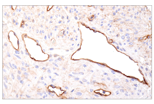 Immunohistochemistry Image 9: CD109 (E4I2V) Rabbit mAb