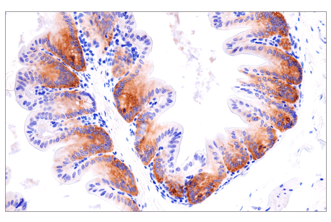 undefined Image 41: SARS-CoV-2 Virus-Host Interaction Antibody Sampler Kit