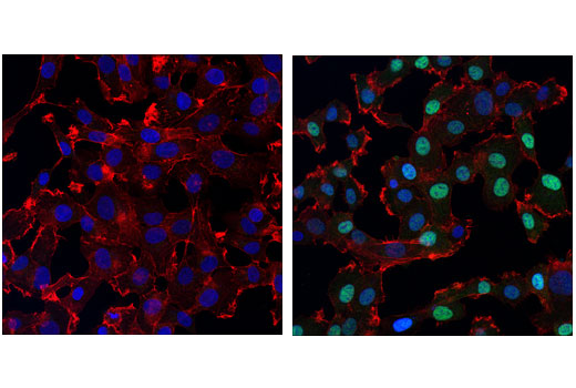 Immunofluorescence Image 1: Phospho-SMAD1 (Ser463/465)/ SMAD5 (Ser463/465)/ SMAD9 (Ser465/467) (D5B10) Rabbit mAb