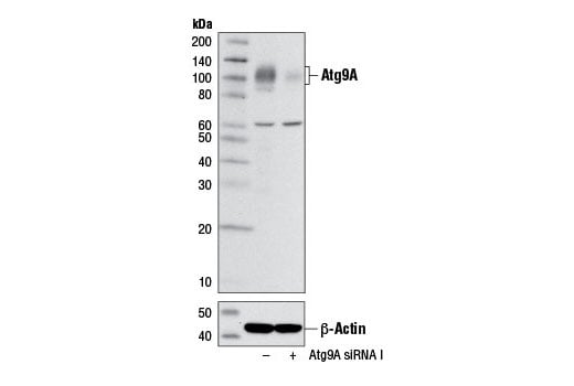 undefined Image 11: Autophagy Vesicle Nucleation Antibody Sampler Kit