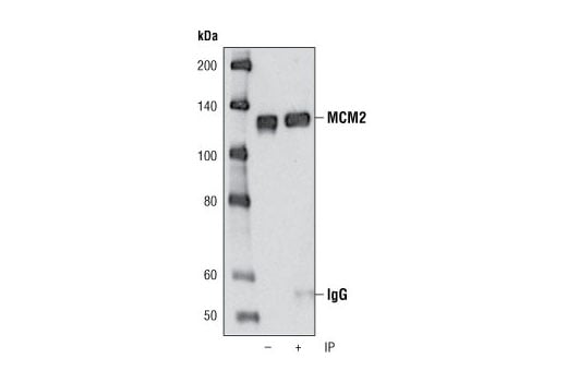 undefined Image 13: Microglia Proliferation Module Antibody Sampler Kit