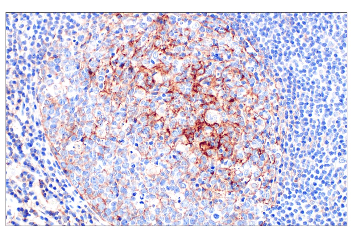 Immunohistochemistry Image 4: CR1/CD35 (E8B1Z) Rabbit mAb