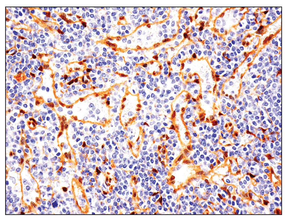 Immunohistochemistry Image 1: YAP (D8H1X) XP<sup>®</sup> Rabbit mAb