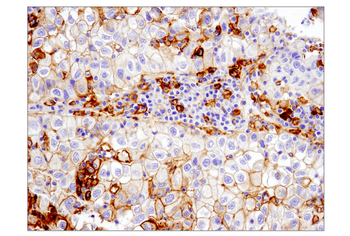 Immunohistochemistry Image 1: PD-L1 (E1L3N<sup>®</sup>) XP<sup>®</sup> Rabbit mAb