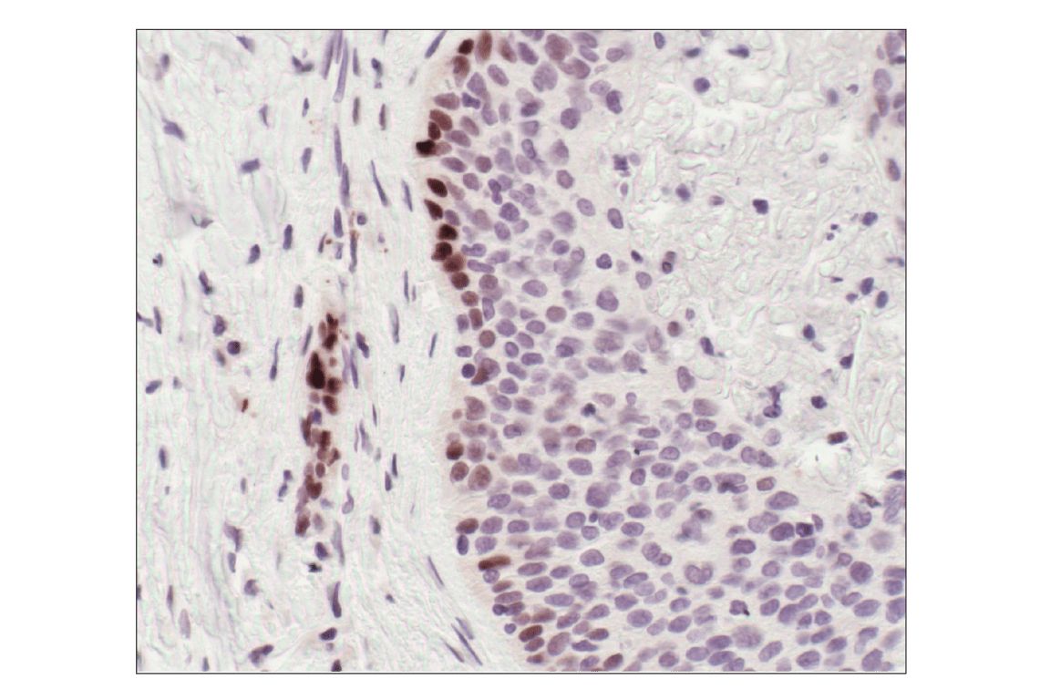 undefined Image 25: Stat3/Stat5 Signaling Antibody Sampler Kit