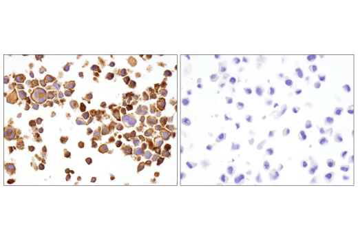 Immunohistochemistry Image 6: LAG3 (D2G4O<sup>™</sup>) XP<sup>®</sup> Rabbit mAb (BSA and Azide Free)