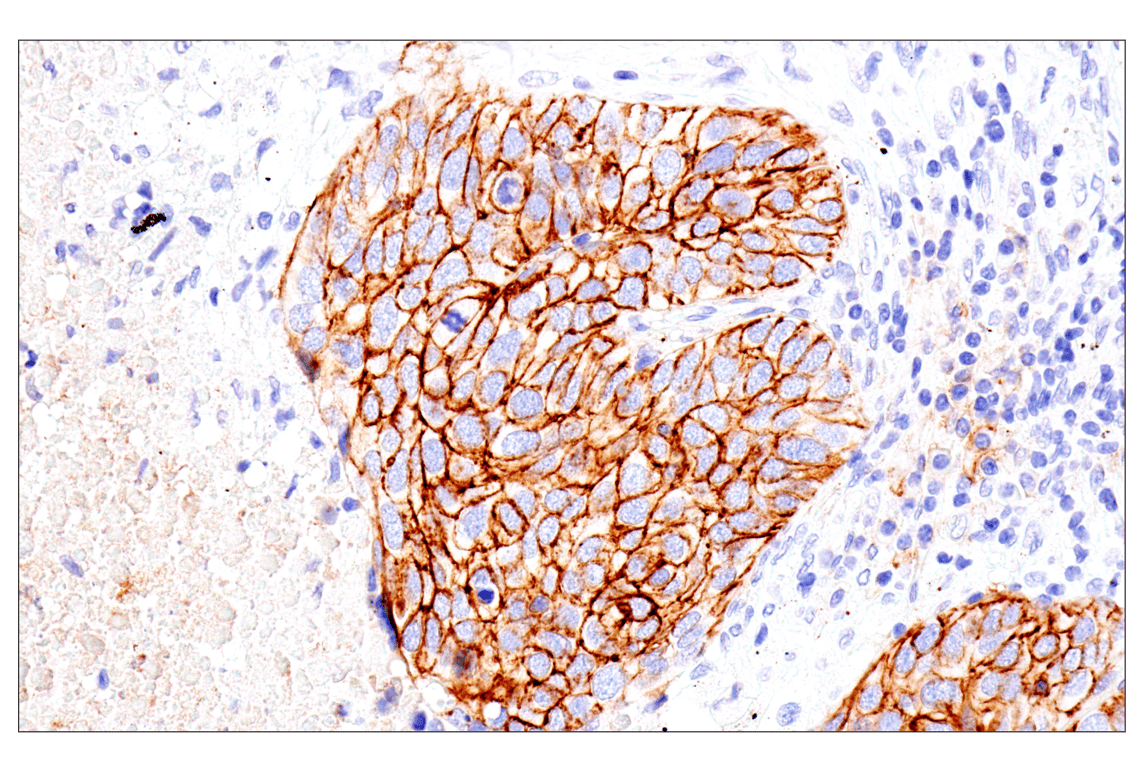 Immunohistochemistry Image 2: Syndecan 1 (E7F7T) Rabbit mAb