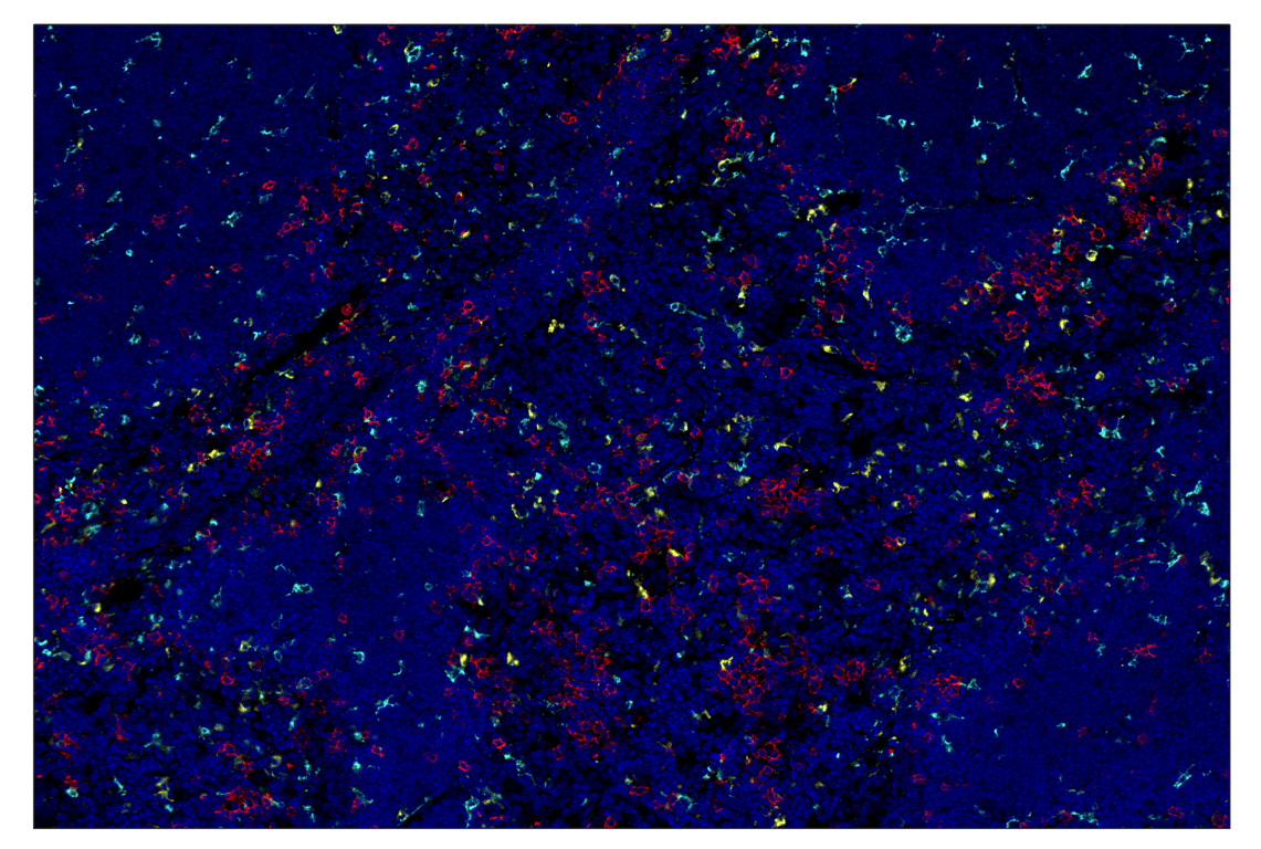 Immunohistochemistry Image 7: CD20 (E3N7O) & CO-0134-750 SignalStar<sup>™</sup> Oligo-Antibody Pair