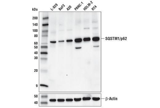 Western Blotting Image 1: SQSTM1/p62 (D1Q5S) Rabbit mAb