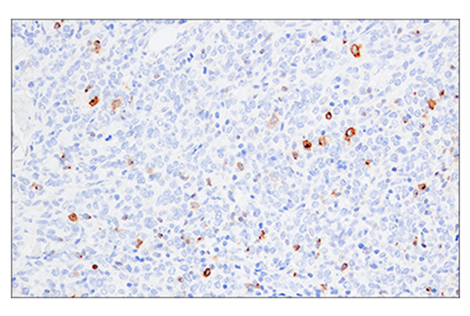 Immunohistochemistry Image 1: 4-1BB/CD137/TNFRSF9 (E6Z7F) XP<sup>®</sup> Rabbit mAb (BSA and Azide Free)