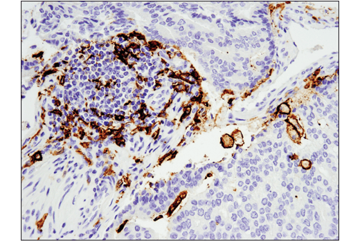 Immunohistochemistry Image 1: CD11c (D3V1E) XP<sup>®</sup> Rabbit mAb