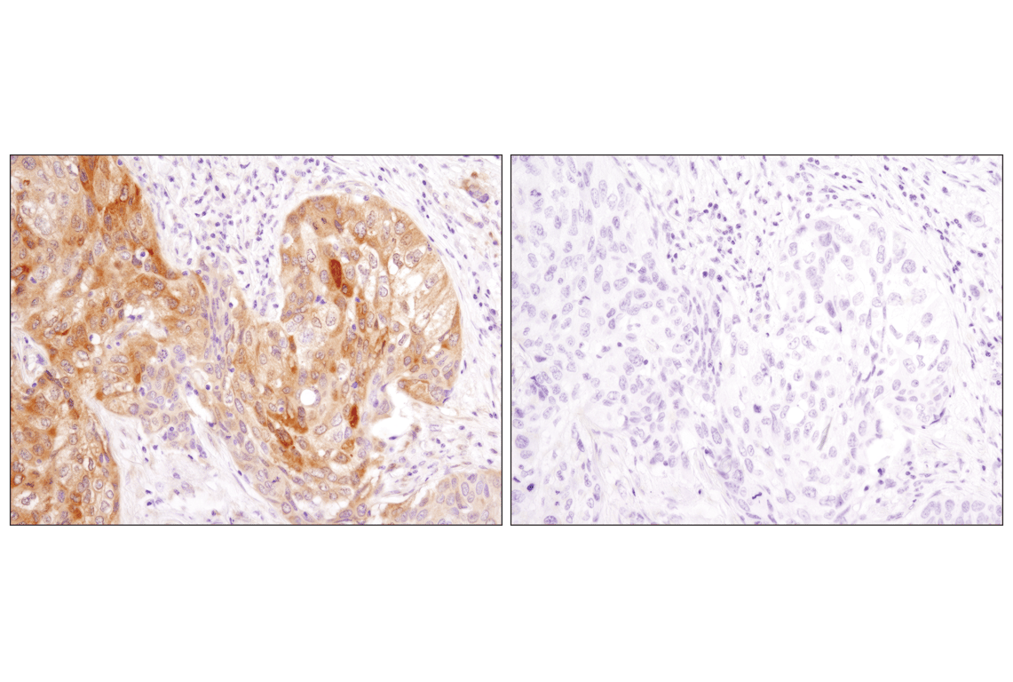 Immunohistochemistry Image 1: LC3A/B (D3U4C) XP<sup>®</sup> Rabbit mAb (BSA and Azide Free)