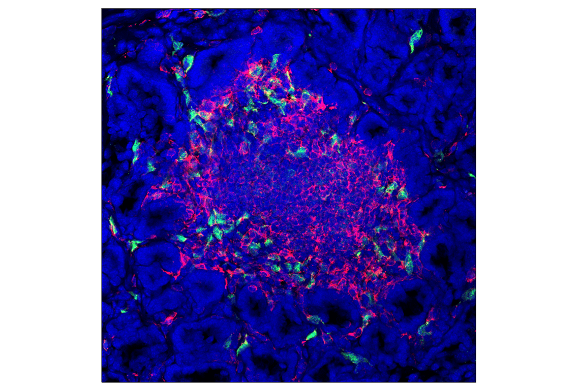 Immunofluorescence Image 1: IRF-5 (E9I4Z) Rabbit mAb (BSA and Azide Free)