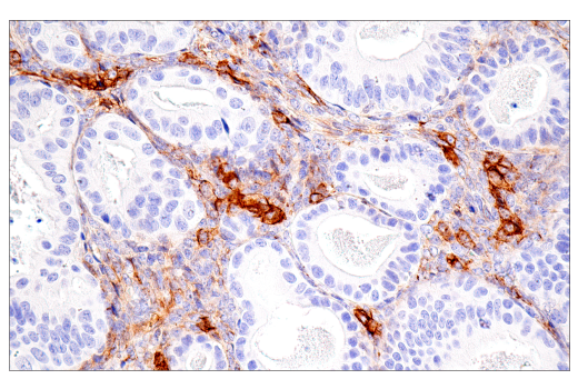 Immunohistochemistry Image 4: CD99 (PCB1) Mouse mAb