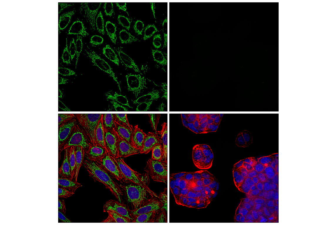 Immunofluorescence Image 1: SCOT1/OXCT1 (F1O1D) Rabbit mAb