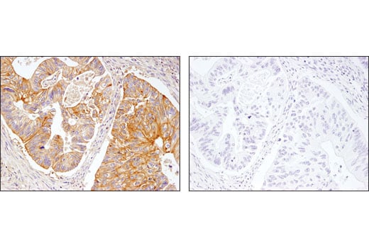 undefined Image 19: MHC Class I Antigen Processing and Presentation Antibody Sampler Kit