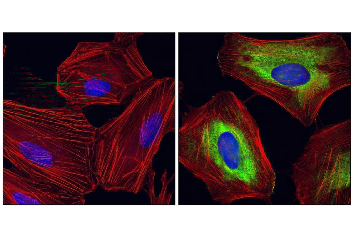 Immunofluorescence Image 1: Phospho-S6 Ribosomal Protein (Ser235/236) (D57.2.2E) XP<sup>®</sup> Rabbit mAb (BSA and Azide Free)
