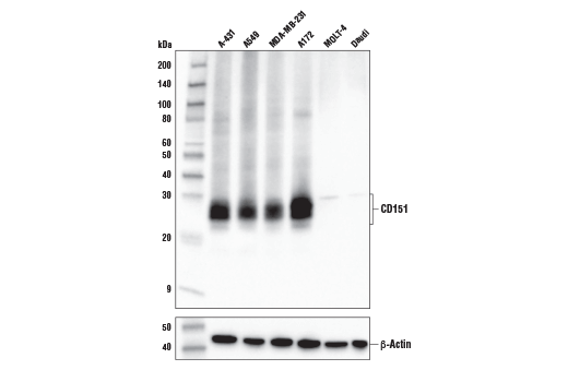 Western Blotting Image 2: CD151 (E9M8T) Rabbit mAb