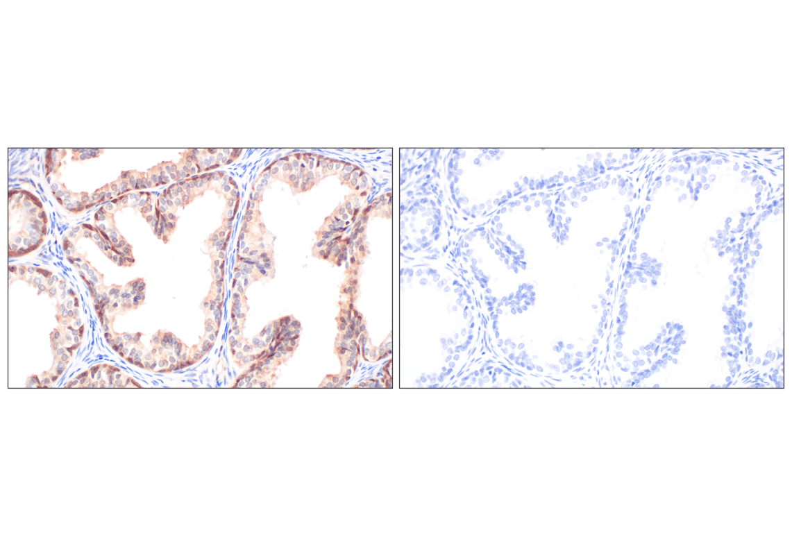 Immunohistochemistry Image 11: Galectin-8/LGALS8 (F9O3T) Rabbit mAb