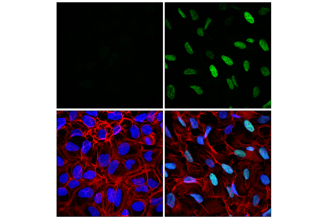 Immunofluorescence Image 1: MDM2 (F7W7X) Rabbit mAb