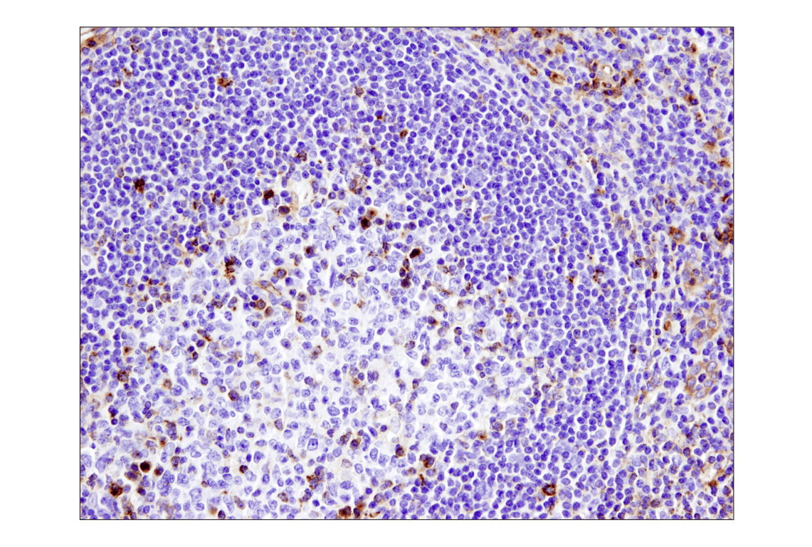 Immunohistochemistry Image 1: VISTA (D1L2G<sup>™</sup>) XP<sup>®</sup> Rabbit mAb