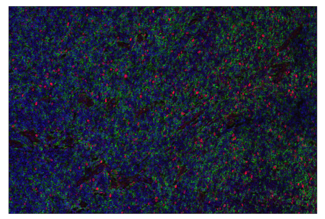 Immunohistochemistry Image 2: Ezh2 (D2C9) & CO-0167-594 SignalStar<sup>®</sup> Oligo-Antibody Pair