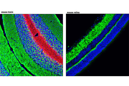 undefined Image 7: Tau Mouse Model Neuronal Viability IF Antibody Sampler Kit