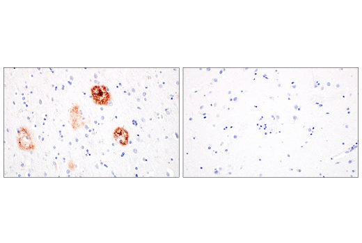 Immunohistochemistry Image 3: β-Amyloid (1-42) (E6D5M) Rabbit mAb (BSA and Azide Free)
